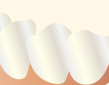 歯と歯茎